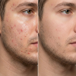 Power Enhancement Duo Men